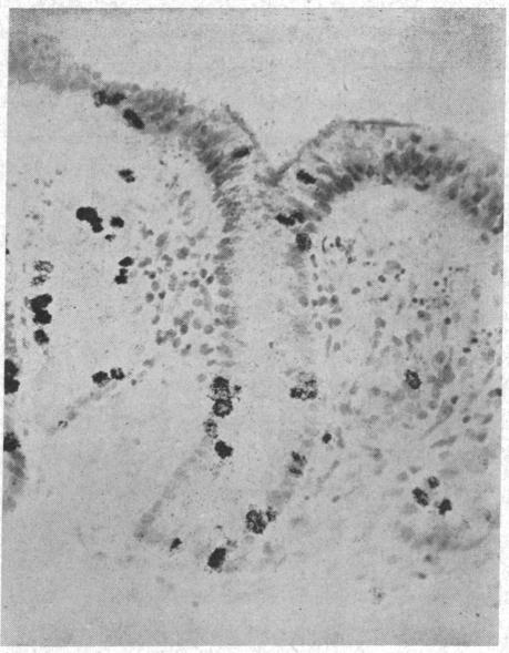 https://cdn.ncbi.nlm.nih.gov/pmc/blobs/2514/289480/081e894d11f9/jcinvest00288-0099-a.jpg