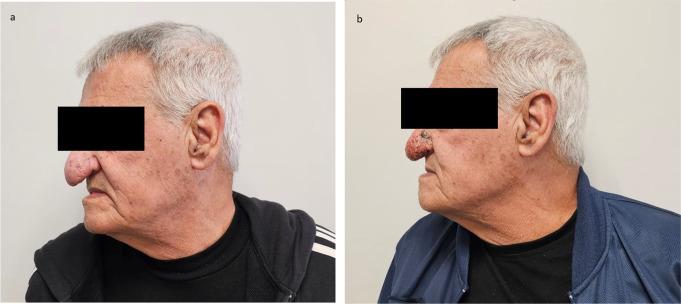 https://cdn.ncbi.nlm.nih.gov/pmc/blobs/2515/12146221/f66fe74c62f3/10103_2025_4442_Fig1_HTML.jpg