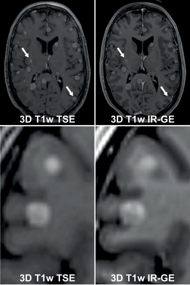 https://cdn.ncbi.nlm.nih.gov/pmc/blobs/2518/10784363/26899500de5e/66_2023_2183_Fig3_HTML.jpg