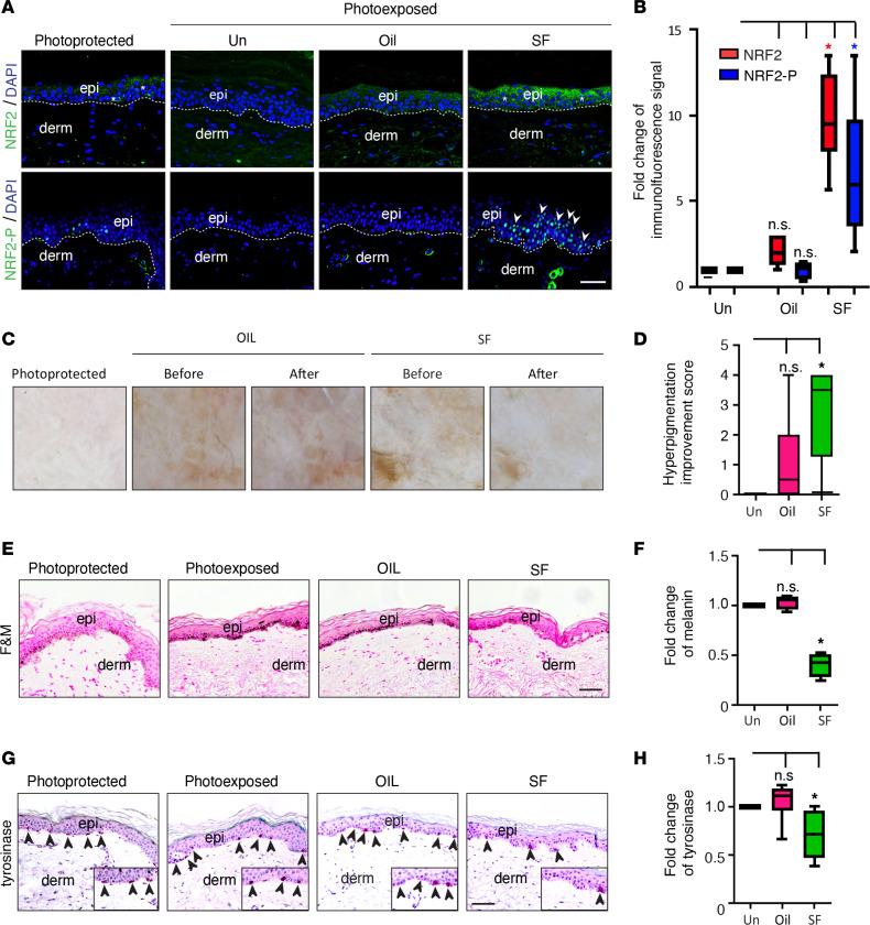 https://cdn.ncbi.nlm.nih.gov/pmc/blobs/251b/7605539/3015c234b1bf/jciinsight-5-139342-g241.jpg
