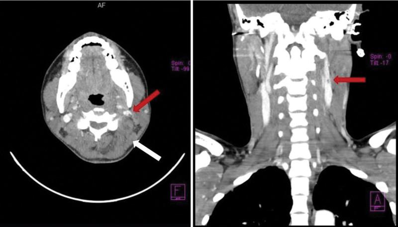 https://cdn.ncbi.nlm.nih.gov/pmc/blobs/251c/10869080/6b8368359505/medi-103-e37006-g002.jpg
