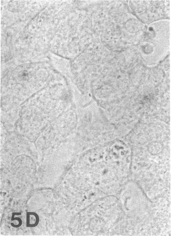 https://cdn.ncbi.nlm.nih.gov/pmc/blobs/2520/295176/99d6abdadf07/jcinvest00058-0246-d.jpg
