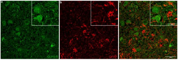 https://cdn.ncbi.nlm.nih.gov/pmc/blobs/2520/9740138/2cb007b0357f/ijms-23-14899-g005.jpg