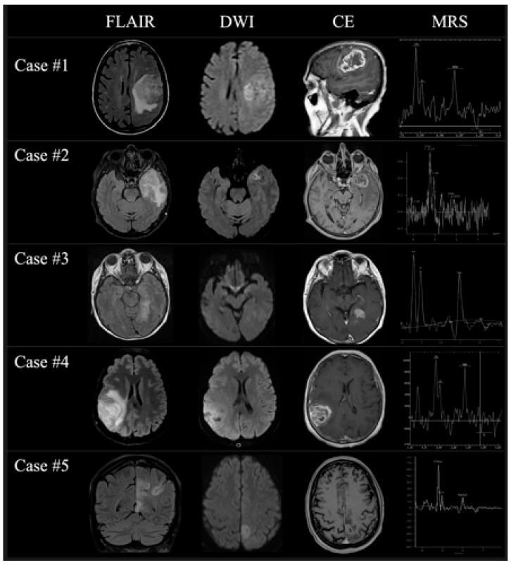 https://cdn.ncbi.nlm.nih.gov/pmc/blobs/2523/12155702/252adcf5fc91/jcm-14-03807-g003.jpg