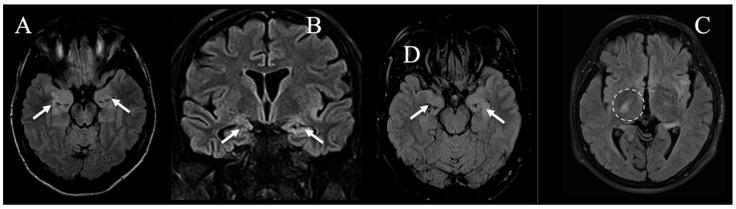 https://cdn.ncbi.nlm.nih.gov/pmc/blobs/2523/12155702/a07b06dc50e0/jcm-14-03807-g002.jpg