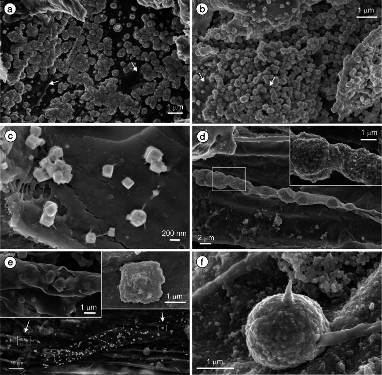 https://cdn.ncbi.nlm.nih.gov/pmc/blobs/2530/4620126/69b6096a56fb/11356_2015_4728_Fig2_HTML.jpg