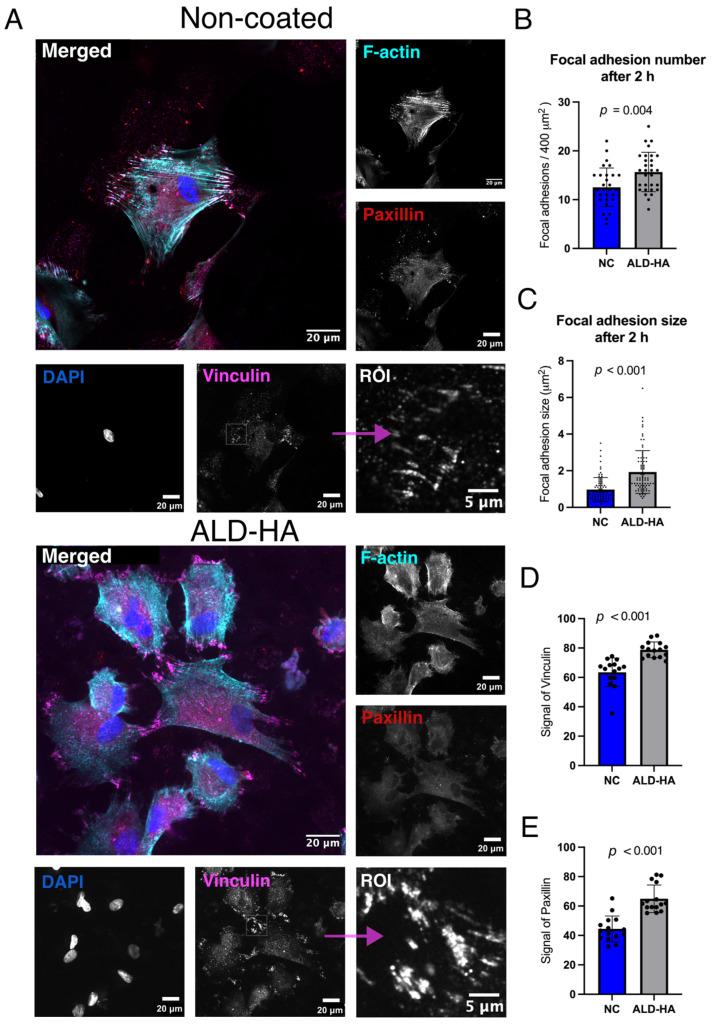https://cdn.ncbi.nlm.nih.gov/pmc/blobs/2531/12195992/ad00ff1b7be8/nanomaterials-15-00887-g005.jpg