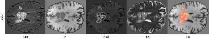 https://cdn.ncbi.nlm.nih.gov/pmc/blobs/2534/12290658/6bd8309eac4c/qims-15-07-6301-f1.jpg