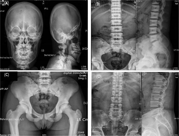 https://cdn.ncbi.nlm.nih.gov/pmc/blobs/2537/6878338/f463f41e12dd/JCRPE-11-439-g1.jpg