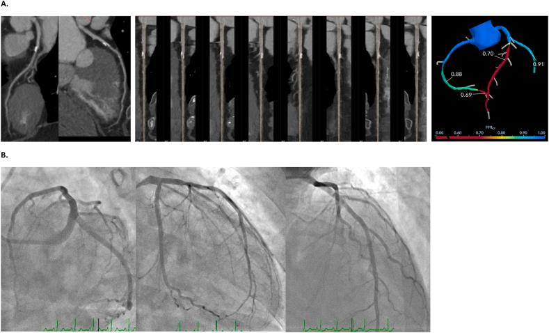 https://cdn.ncbi.nlm.nih.gov/pmc/blobs/2539/10559546/1d1caf337e61/gr5.jpg