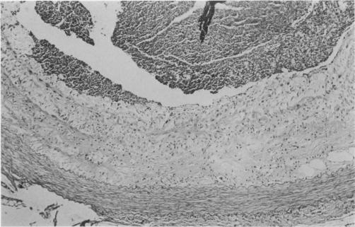 https://cdn.ncbi.nlm.nih.gov/pmc/blobs/2545/2041019/df6fa3bf6548/brjexppathol00085-0046-a.jpg