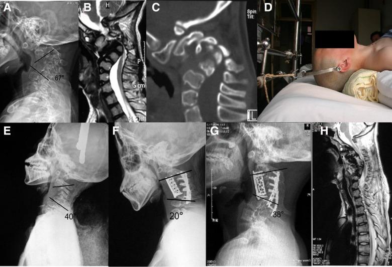 https://cdn.ncbi.nlm.nih.gov/pmc/blobs/254f/9852755/1361f87b3220/fsurg-09-1090199-g001.jpg