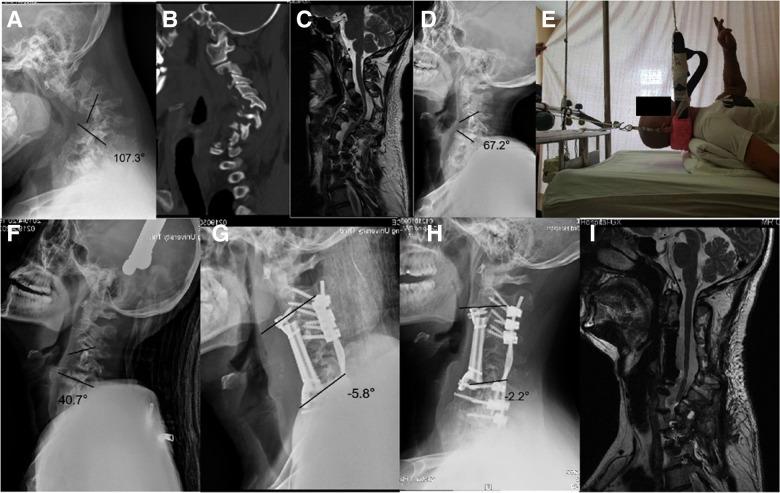 https://cdn.ncbi.nlm.nih.gov/pmc/blobs/254f/9852755/1d8760b2620f/fsurg-09-1090199-g003.jpg