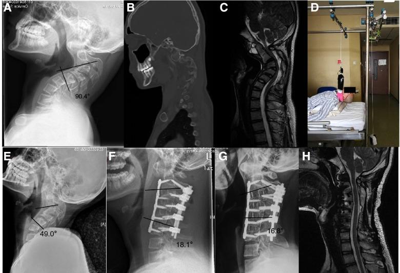 https://cdn.ncbi.nlm.nih.gov/pmc/blobs/254f/9852755/51ca227de45b/fsurg-09-1090199-g002.jpg