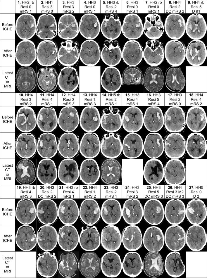 https://cdn.ncbi.nlm.nih.gov/pmc/blobs/2551/10794262/d5aaeb498cef/701_2024_5902_Fig2a_HTML.jpg