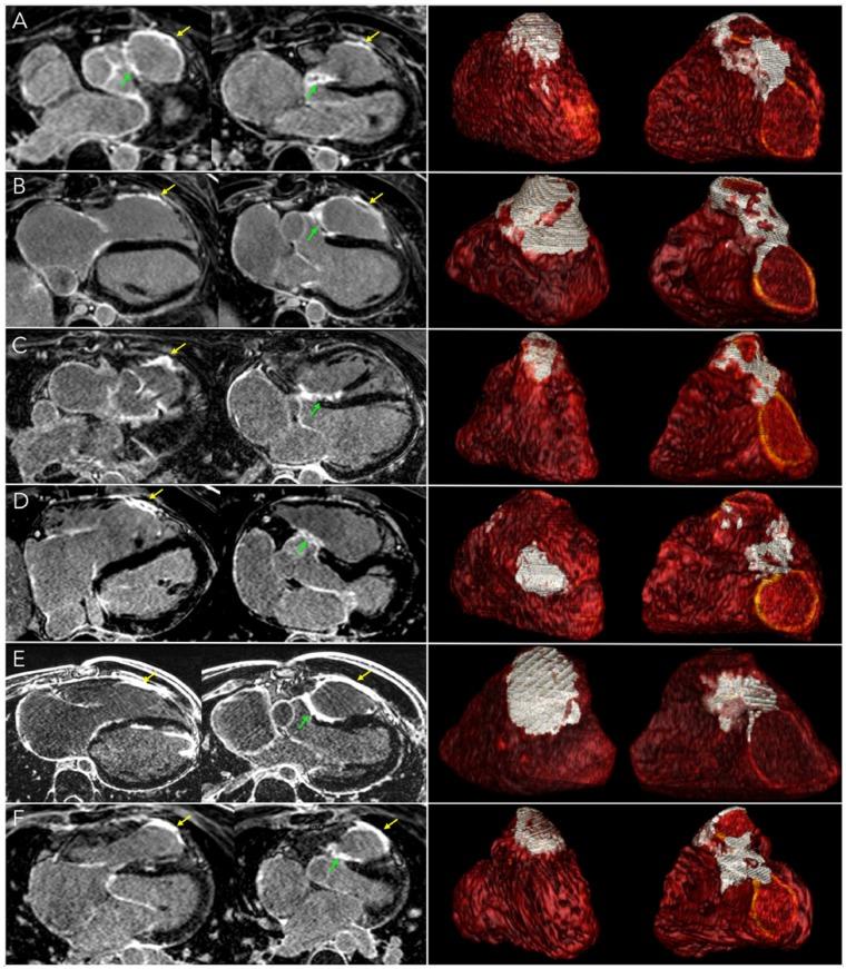 https://cdn.ncbi.nlm.nih.gov/pmc/blobs/255b/6704392/b62859be55c3/jez068f3.jpg