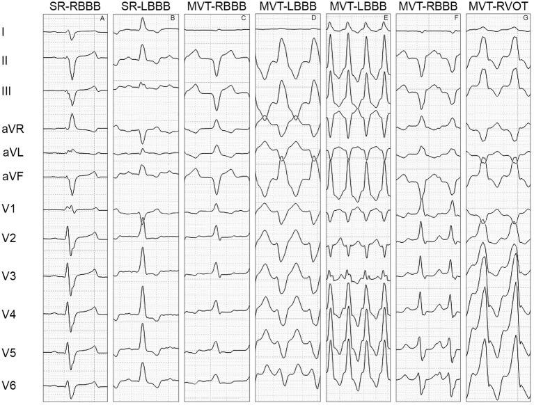 https://cdn.ncbi.nlm.nih.gov/pmc/blobs/2566/12129992/4417dc261a52/fvets-12-1579951-g001.jpg