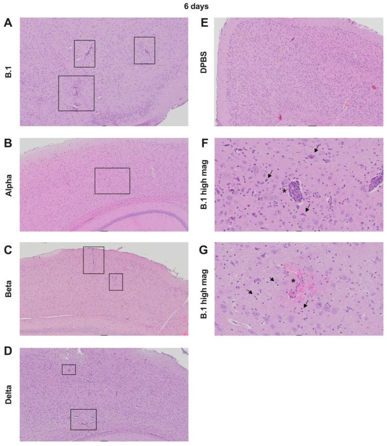 https://cdn.ncbi.nlm.nih.gov/pmc/blobs/2568/12031173/3a2f0a3b3111/viruses-17-00500-g004.jpg
