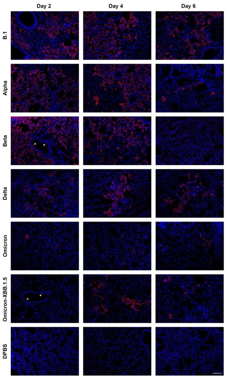 https://cdn.ncbi.nlm.nih.gov/pmc/blobs/2568/12031173/5f770bd08eb2/viruses-17-00500-g007.jpg
