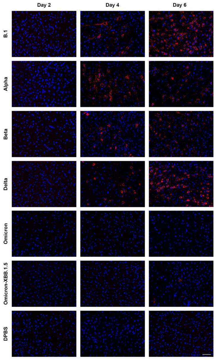 https://cdn.ncbi.nlm.nih.gov/pmc/blobs/2568/12031173/bc33f6e26b00/viruses-17-00500-g009.jpg