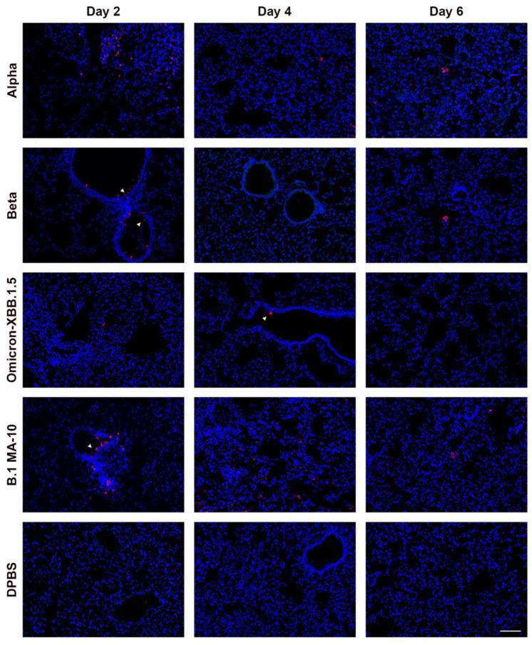 https://cdn.ncbi.nlm.nih.gov/pmc/blobs/2568/12031173/c34726d13f50/viruses-17-00500-g008.jpg