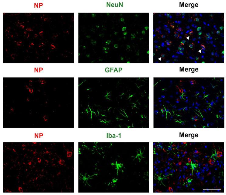 https://cdn.ncbi.nlm.nih.gov/pmc/blobs/2568/12031173/c7a2c6541987/viruses-17-00500-g010.jpg
