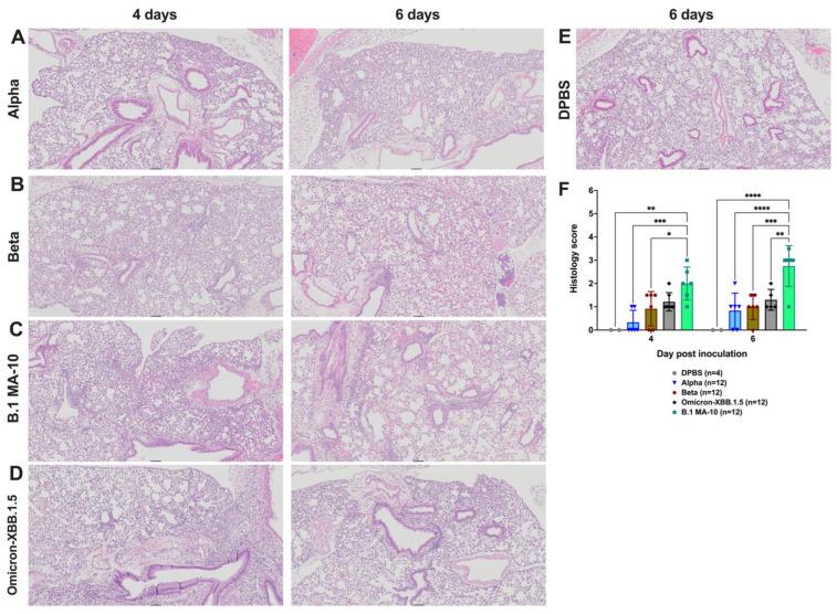 https://cdn.ncbi.nlm.nih.gov/pmc/blobs/2568/12031173/f319f4cbb6f3/viruses-17-00500-g006.jpg