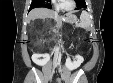 https://cdn.ncbi.nlm.nih.gov/pmc/blobs/2568/5635638/0a45f4ab70a6/BMJ-34-476-g1.jpg