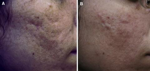 https://cdn.ncbi.nlm.nih.gov/pmc/blobs/256b/2696608/f212b67ffb4e/266_2008_9242_Fig1_HTML.jpg