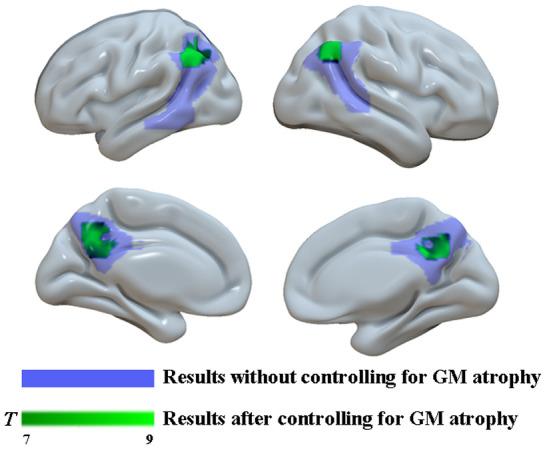 https://cdn.ncbi.nlm.nih.gov/pmc/blobs/2579/7993730/458a4261f808/aging-13-202580-g005.jpg