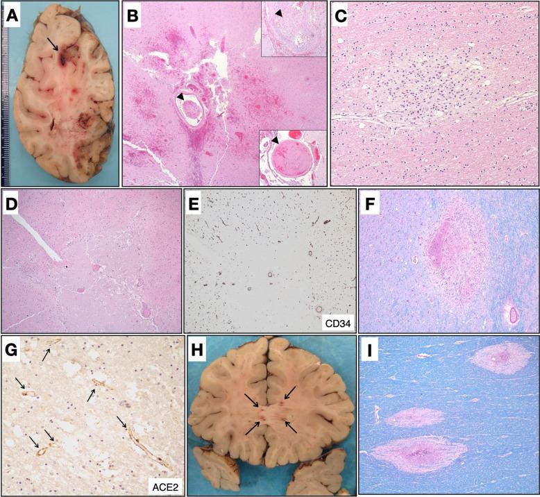 https://cdn.ncbi.nlm.nih.gov/pmc/blobs/257c/9813608/1c7e389adabd/gr3_lrg.jpg
