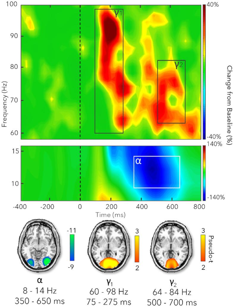 https://cdn.ncbi.nlm.nih.gov/pmc/blobs/257d/12392304/dc562b831d56/IMAG.a.120_fig3.jpg