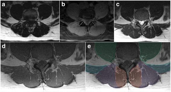 https://cdn.ncbi.nlm.nih.gov/pmc/blobs/257e/5247810/9fca2f63ee32/12891_2016_1378_Fig3_HTML.jpg