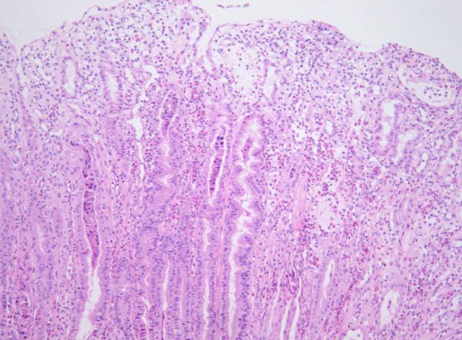 https://cdn.ncbi.nlm.nih.gov/pmc/blobs/2583/3433566/3a4173850b45/kjped-55-293-g002.jpg