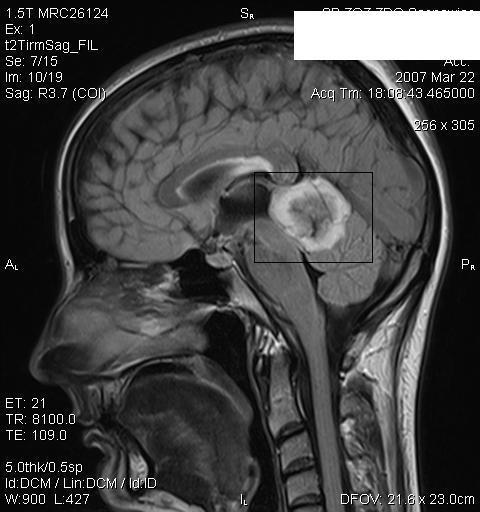https://cdn.ncbi.nlm.nih.gov/pmc/blobs/2588/2723072/f0142be4439b/1471-2377-9-39-4.jpg
