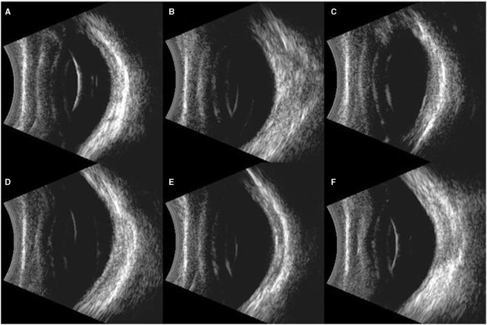 https://cdn.ncbi.nlm.nih.gov/pmc/blobs/2588/8495021/b4512f838a30/fmed-08-749351-g0006.jpg