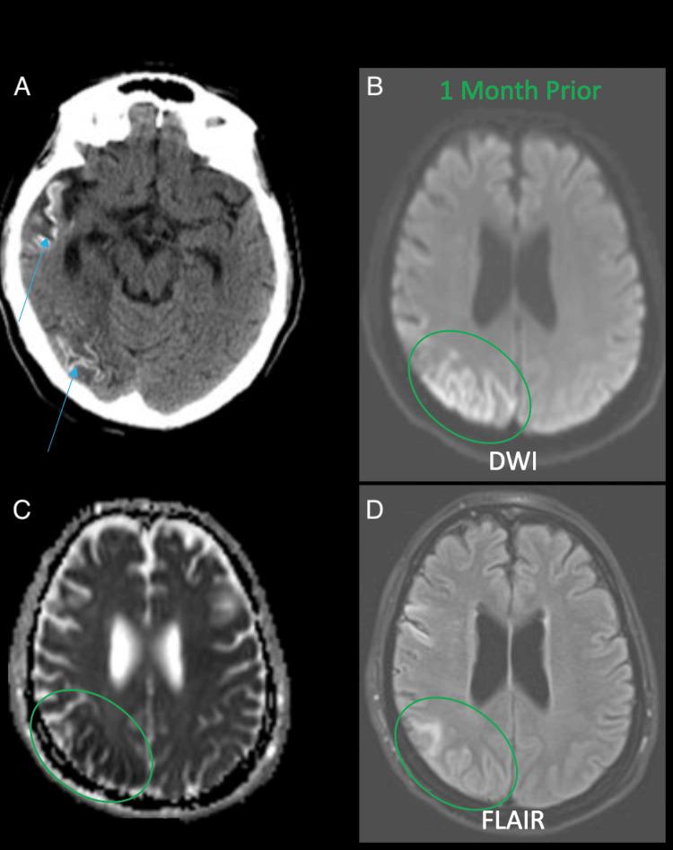 https://cdn.ncbi.nlm.nih.gov/pmc/blobs/258a/11019475/0b53fa86135a/cureus-0016-00000056317-i02.jpg