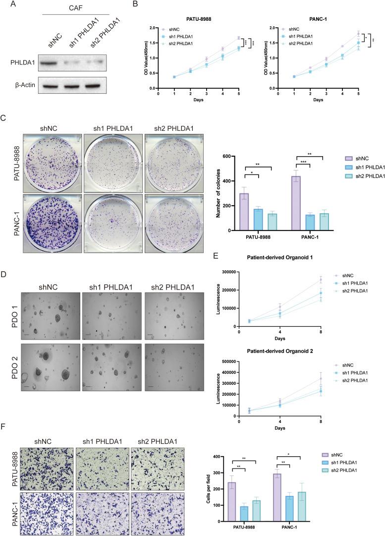 https://cdn.ncbi.nlm.nih.gov/pmc/blobs/258d/12271128/a0eee0d49fe6/fimmu-16-1592416-g010.jpg