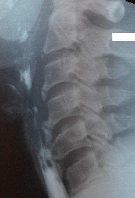 https://cdn.ncbi.nlm.nih.gov/pmc/blobs/2590/6620073/4108ab1405b9/PAMJ-32-189-g001.jpg