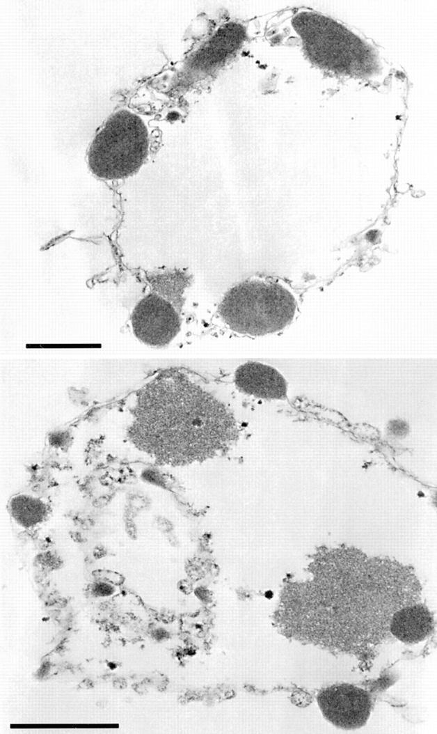 https://cdn.ncbi.nlm.nih.gov/pmc/blobs/2595/2132820/8b6e46503e93/JCB9807090.f7.jpg