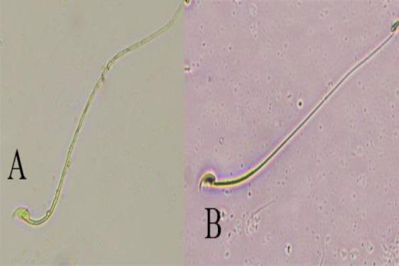 https://cdn.ncbi.nlm.nih.gov/pmc/blobs/2595/6941692/660ff05d0248/AJP-10-035-g002.jpg