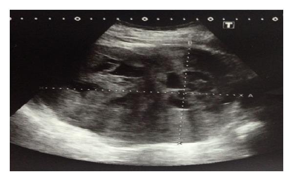 https://cdn.ncbi.nlm.nih.gov/pmc/blobs/2596/4137535/49b0056b3b8a/CRIU2014-354687.001.jpg