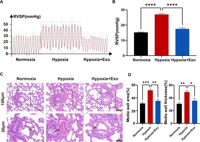 https://cdn.ncbi.nlm.nih.gov/pmc/blobs/259a/12234707/9cd6e5e018d4/41598_2025_9333_Fig5_HTML.jpg