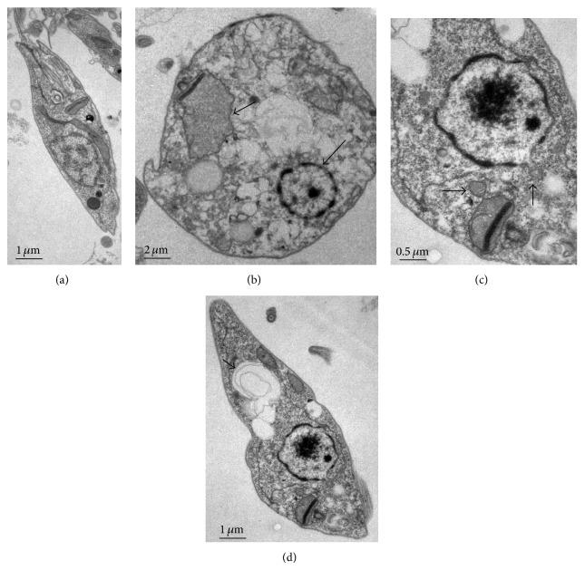https://cdn.ncbi.nlm.nih.gov/pmc/blobs/259c/4352472/b15daadd17c9/ECAM2015-620472.002.jpg
