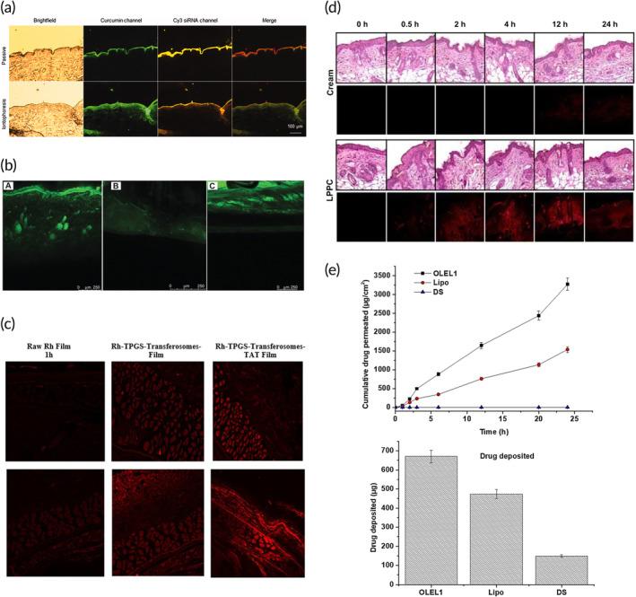 https://cdn.ncbi.nlm.nih.gov/pmc/blobs/25a6/10905562/c09e7fa698ea/BTM2-9-e10601-g010.jpg