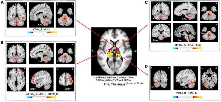 https://cdn.ncbi.nlm.nih.gov/pmc/blobs/25a8/9630740/5bad61390509/fnins-16-1026200-g001.jpg