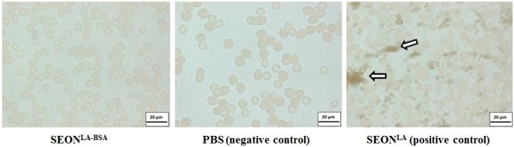 https://cdn.ncbi.nlm.nih.gov/pmc/blobs/25aa/4581297/100aa46e7a09/ijms-16-19291-g006.jpg