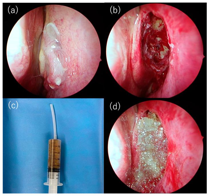 https://cdn.ncbi.nlm.nih.gov/pmc/blobs/25b0/11764751/c6b8350997c9/gels-11-00060-g005.jpg