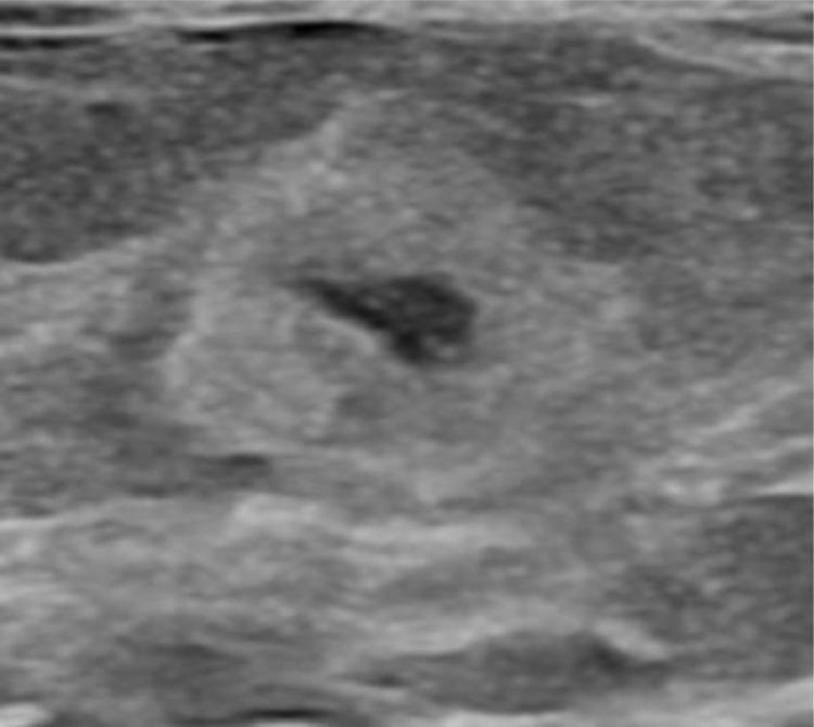 https://cdn.ncbi.nlm.nih.gov/pmc/blobs/25b4/10789930/3f011f2cf37b/gr2.jpg