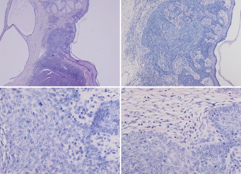 https://cdn.ncbi.nlm.nih.gov/pmc/blobs/25b6/3887160/967aaf5a383f/kjpathol-47-569-g003.jpg